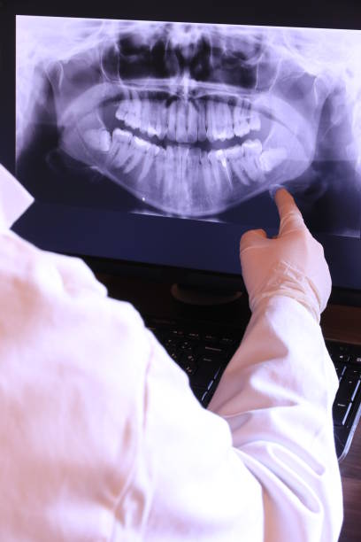 Best Tooth Infection Emergency Dentist  in Kentfield, CA